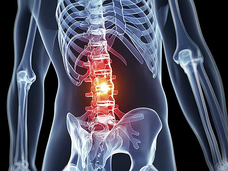 Other common causes of back pain include: