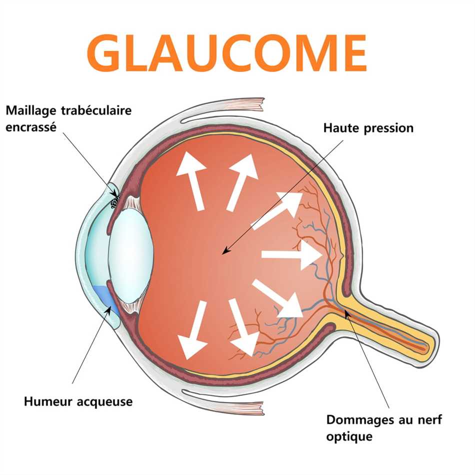 Amitriptyline et glaucome