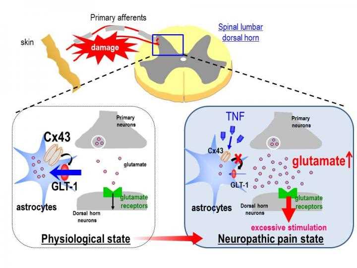 Mechanism of amitriptyline in neuropathic pain