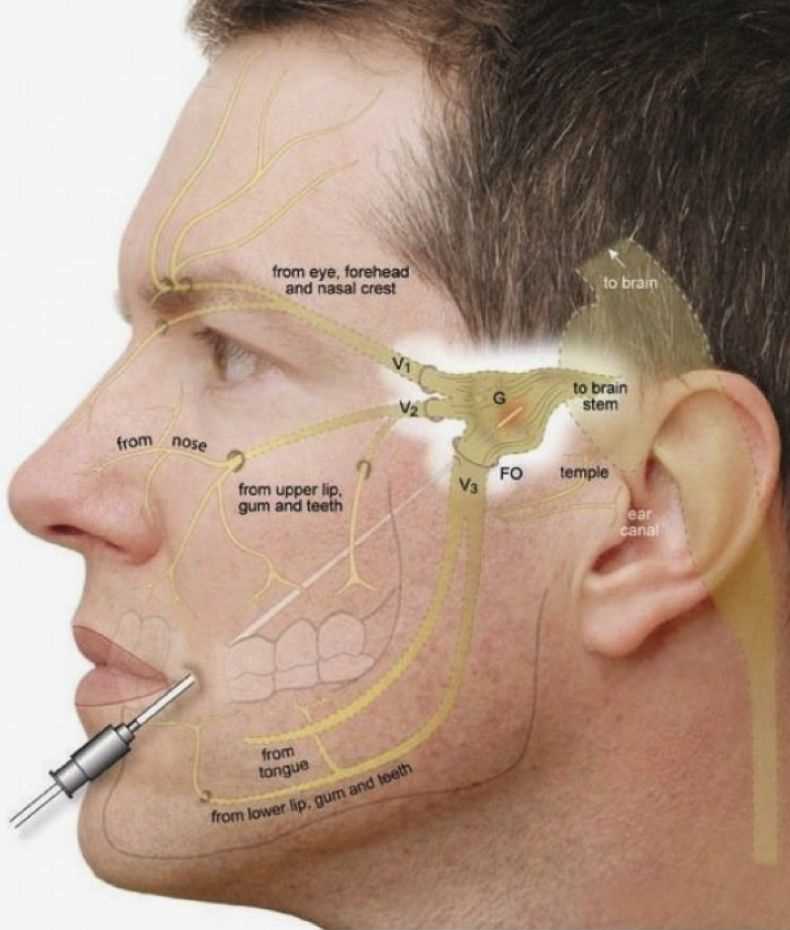 Shingles and amitriptyline